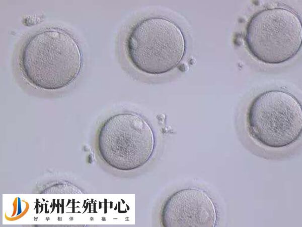 杭州哪个公立医院可以供卵做三代试管婴儿？