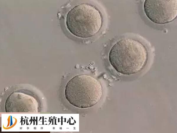 浅析哪些情况不能移植鲜胚，内膜情况不好是其一
