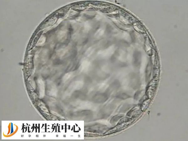 胚胎移植失败有什么预兆