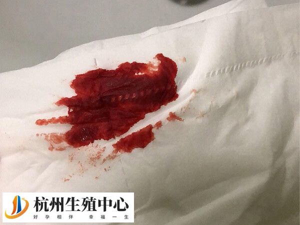 移植十四天出血腹痛不排除是流产的先兆